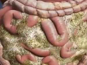 광고이미지1